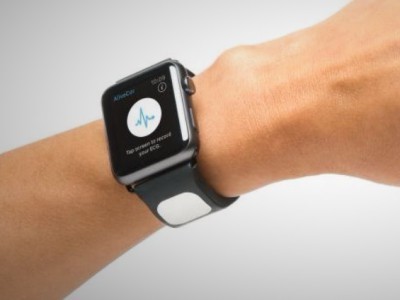Ремешок AliveCor Kardia Band для Apple Watch поможет предсказать инфаркт